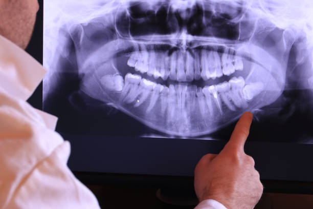 Best Emergency Dentist for Lost Fillings or Crowns in Bloomingdale, IL