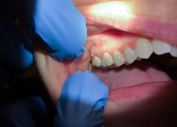 Best Pediatric Emergency Dentist in Bloomingdale, IL